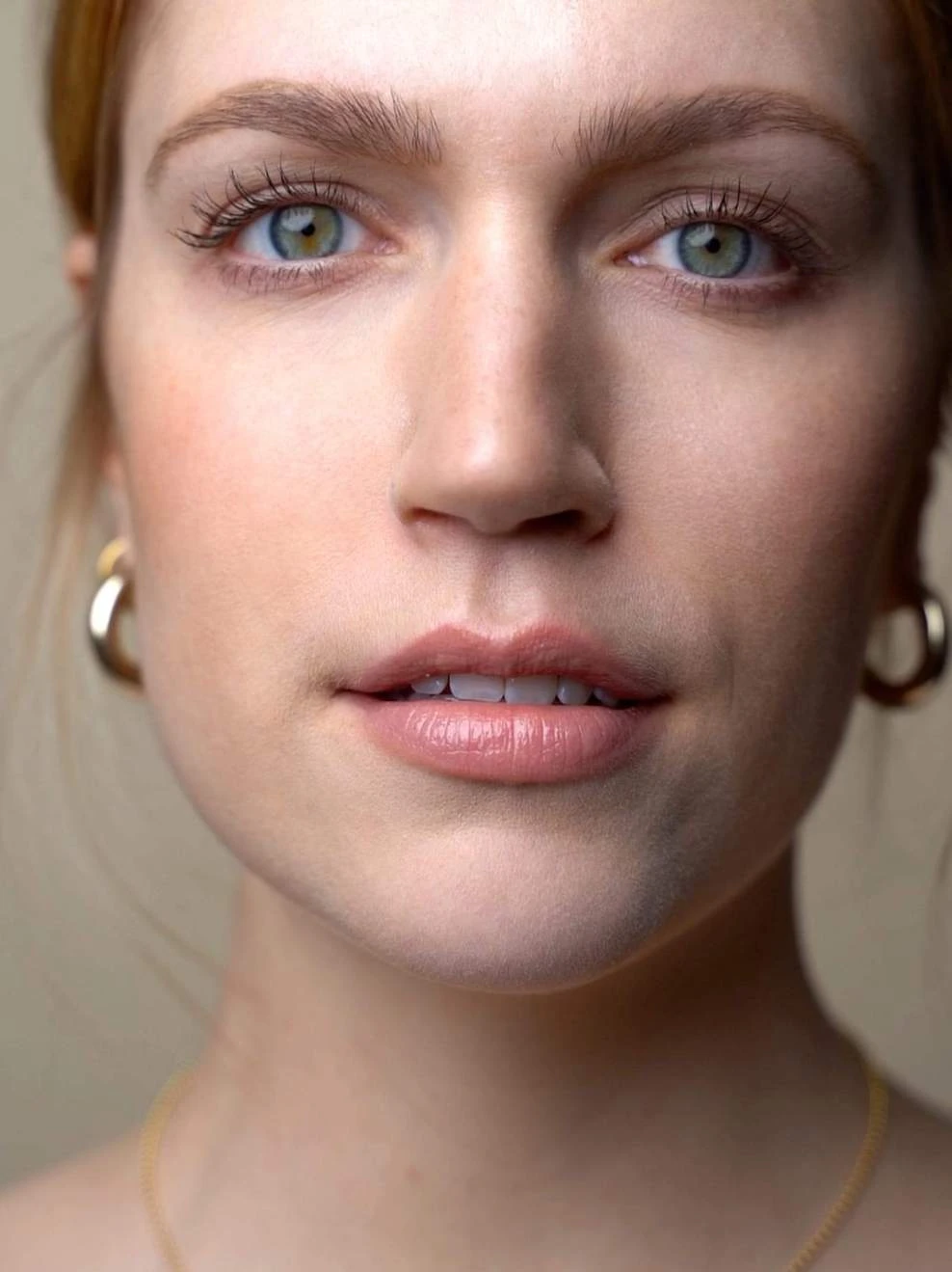 SPRUSSE 11 SPRUSSE - Image 9